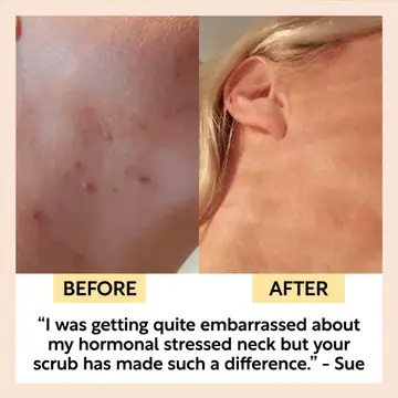 Upcircle - Face Scrub Coffee + Rosehip [Citrus] Vegan, Eco Exfoliator